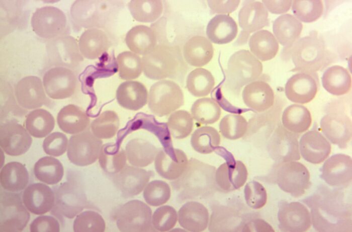 Trypanosoma-cruzi3-scaled.jpg