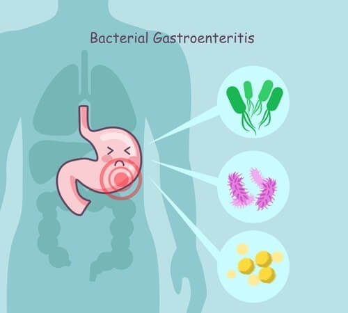 bakterialnyj-gastroenterit-cheloveka.jpg