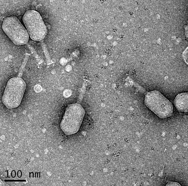 bakteriofagi-pod-mikroskopom.jpg