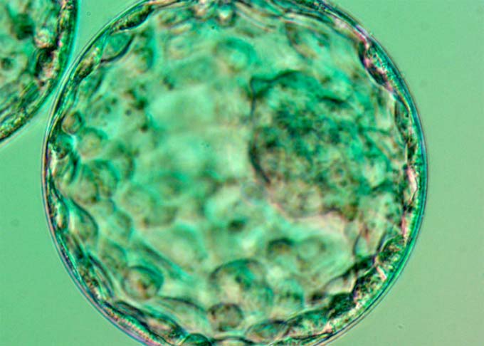 blastocista-6.jpg