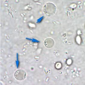 blastocystis-spp-u-rebenka.jpg