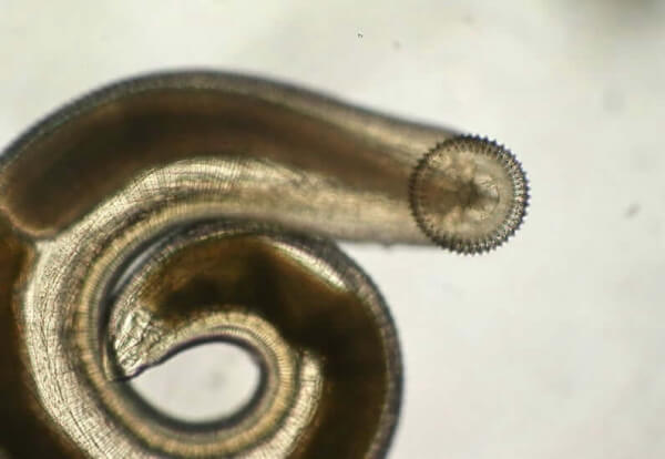 gnathostoma-spinigerum.jpg