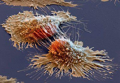 Распространение раковых клеток