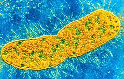 Бактерия клебсиелла
