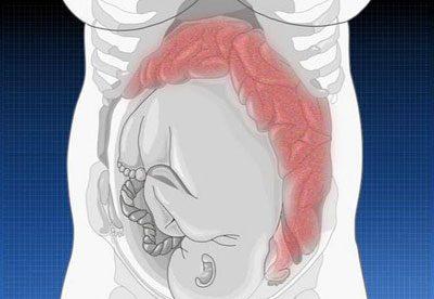 Расположение желудка при беременности