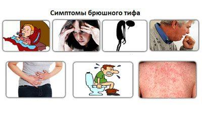 Симптомы брюшного тифа